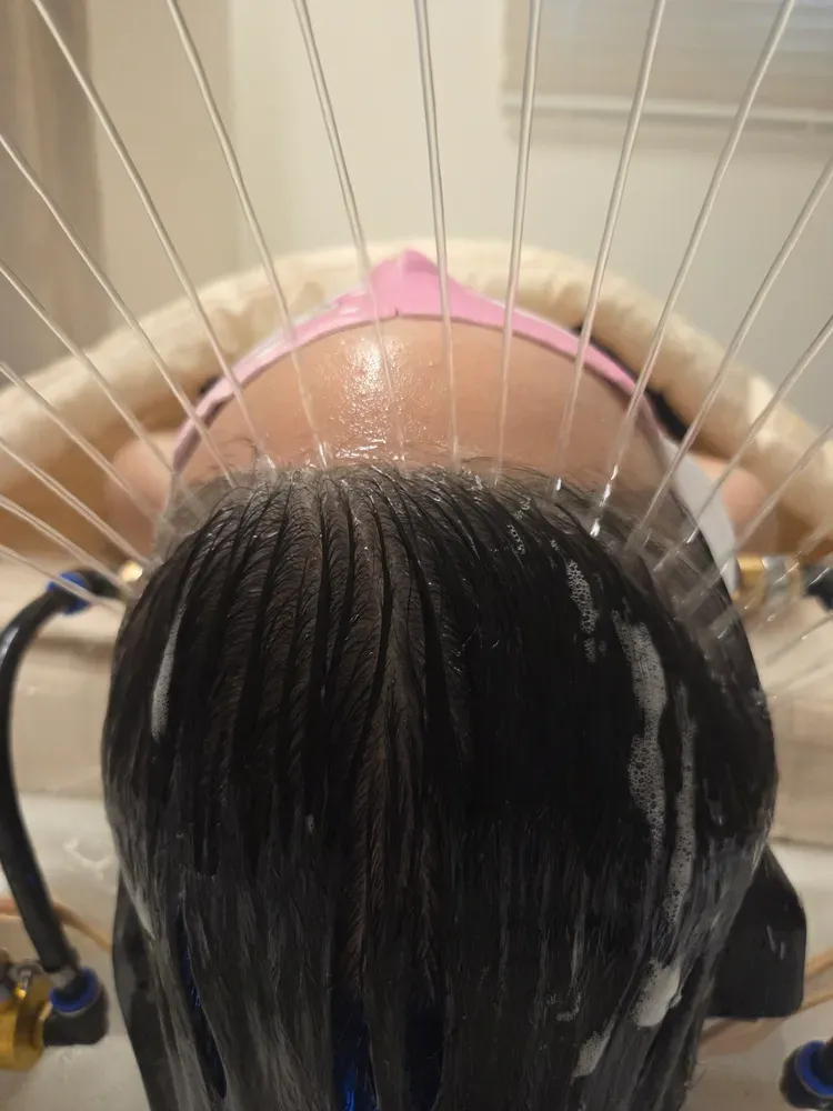 [충북 충주] 원스킨